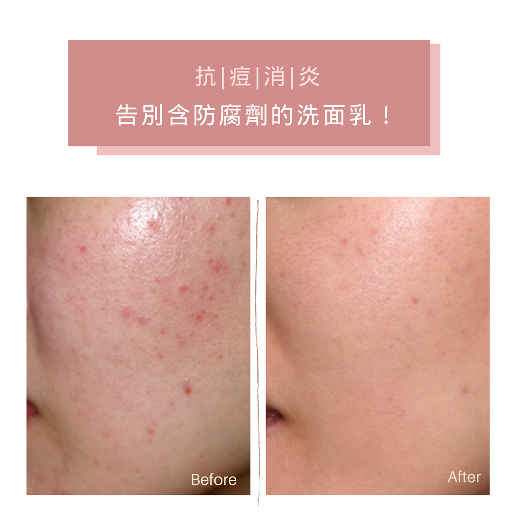 Face Wash 溫和洗面乳